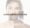 LASER SKIN RESURFACING