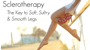 Sclerotherapy Varicose vein treatment Spider vein removal Vein treatment Darien CT Sclerotherapy Darien CT Vein-free legs Vein removal Leg vein treatment Non-surgical vein treatment Cosmetic vein treatment