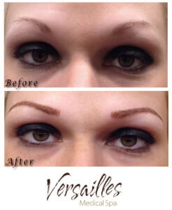 Microblading Microblading Fairfield County Microblading Darien CT Eyebrow Microblading Versailles Medical Spa Best Medical Spa Fairfield County Natural Eyebrow Enhancement Microblading Before and After Organic Pigment Microblading Eyebrow Restoration