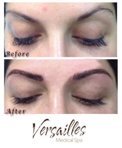 Microblading process Microblading expectations Microblading Darien CT Versailles Medical Spa microblading Eyebrow microblading Microblading consultation Microblading treatment steps Microblading healing Microblading results Microblading by Marie