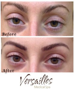 Microblading Microblading Connecticut Microblading Darien CT Experienced Microblading Provider Eyebrow Microblading Versailles Medical Spa Best Microblading Fairfield County Natural Eyebrow Enhancement Organic Pigment Microblading Eyebrow Restoration