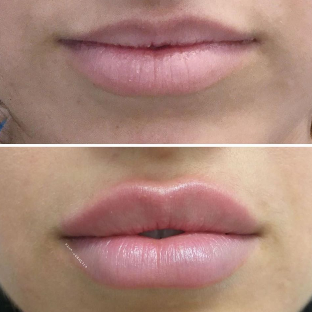 RHA FILLER (Instagram Post) (1)