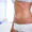 CoolSculpting Darien CT