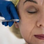 Sculptra benefits Darien CT