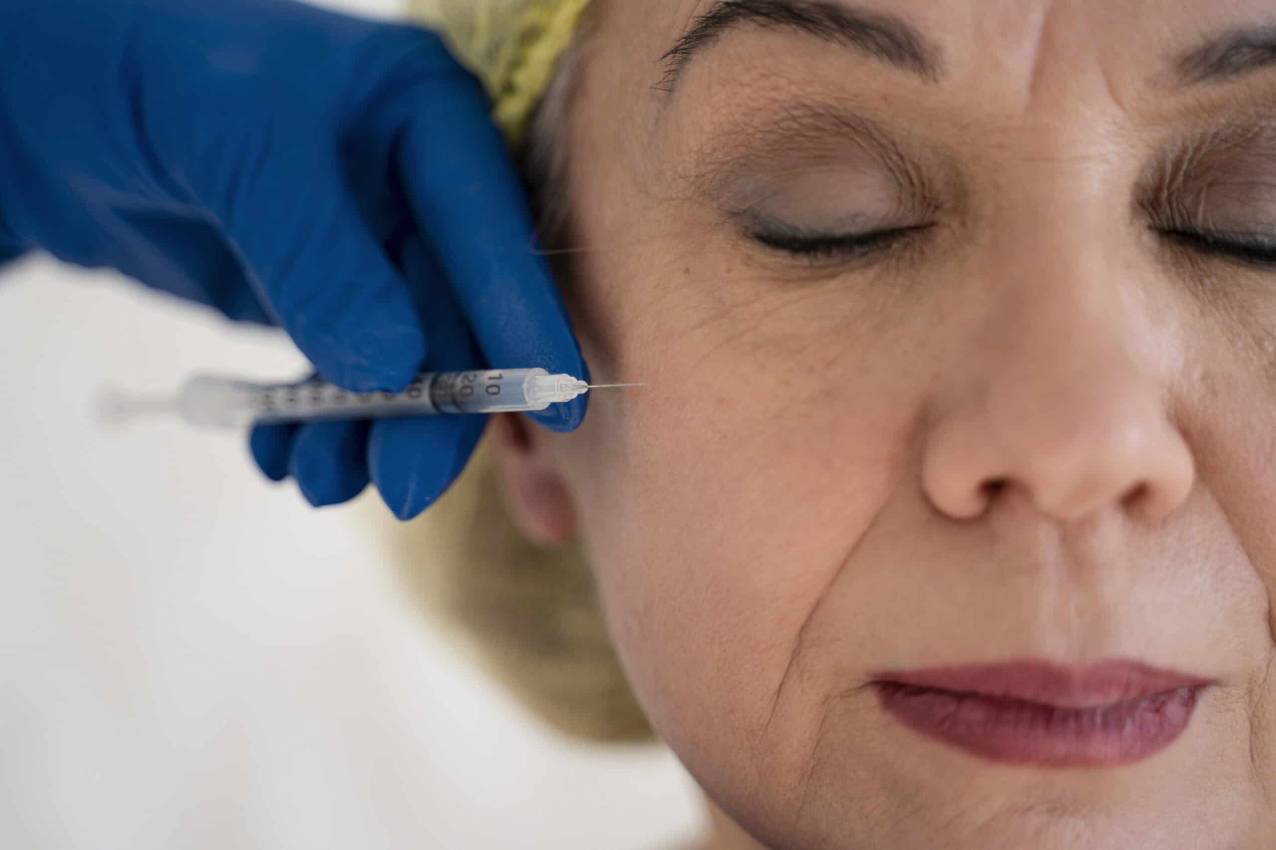 Sculptra benefits Darien CT