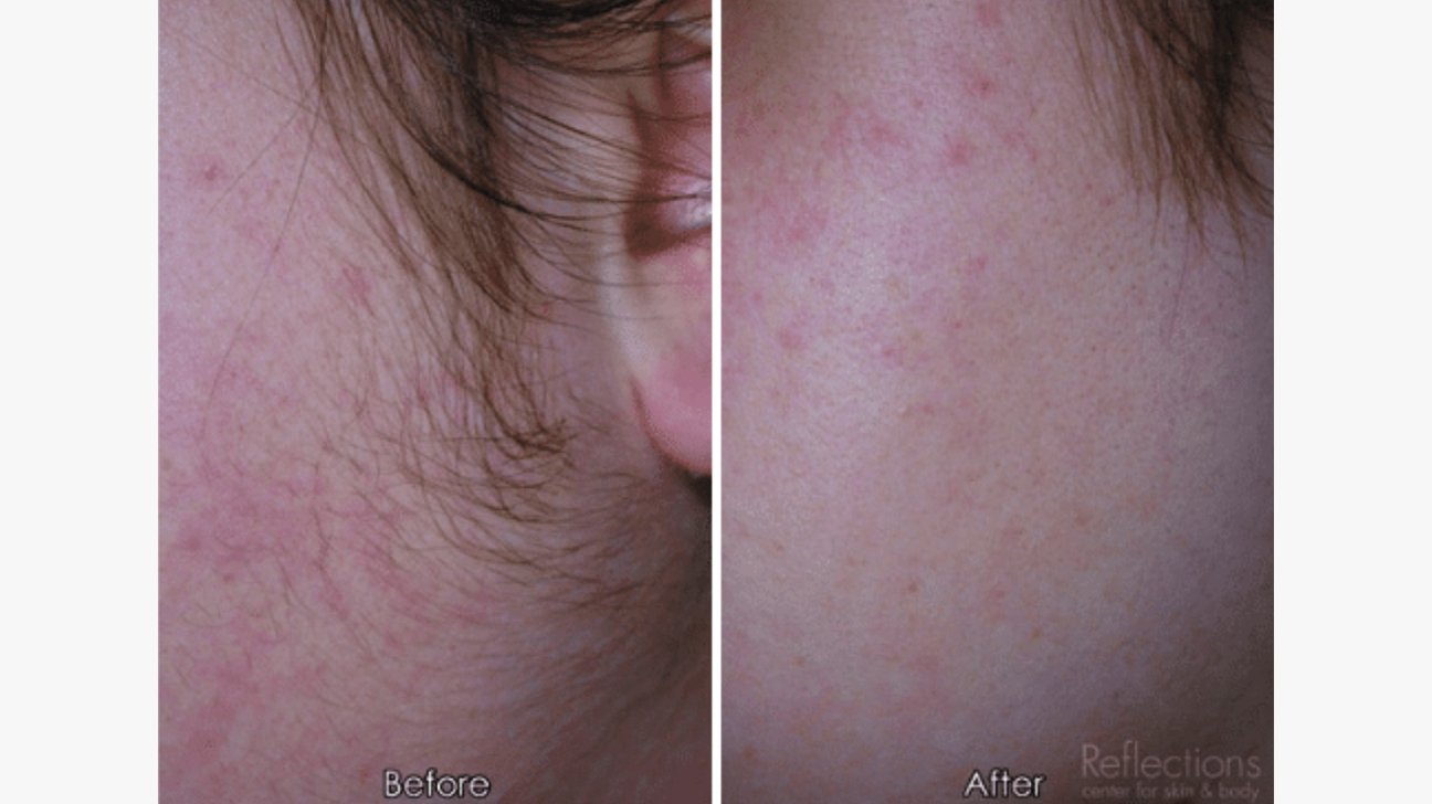 Reflections The Center for Cosmetic Medicine