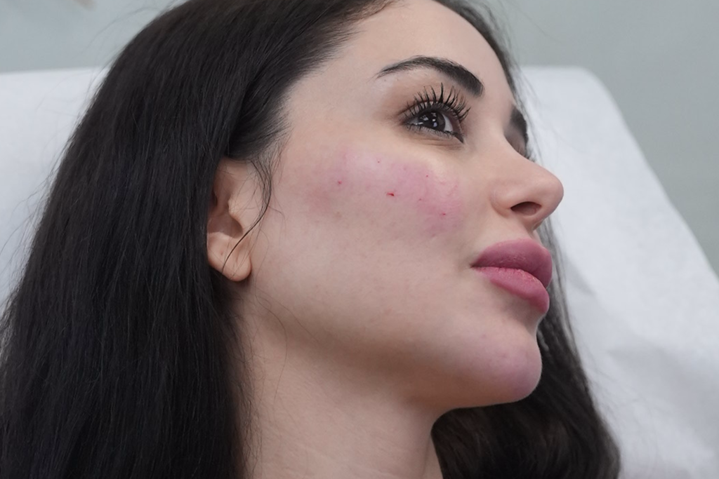 SKINVIVE Fairfield County CT