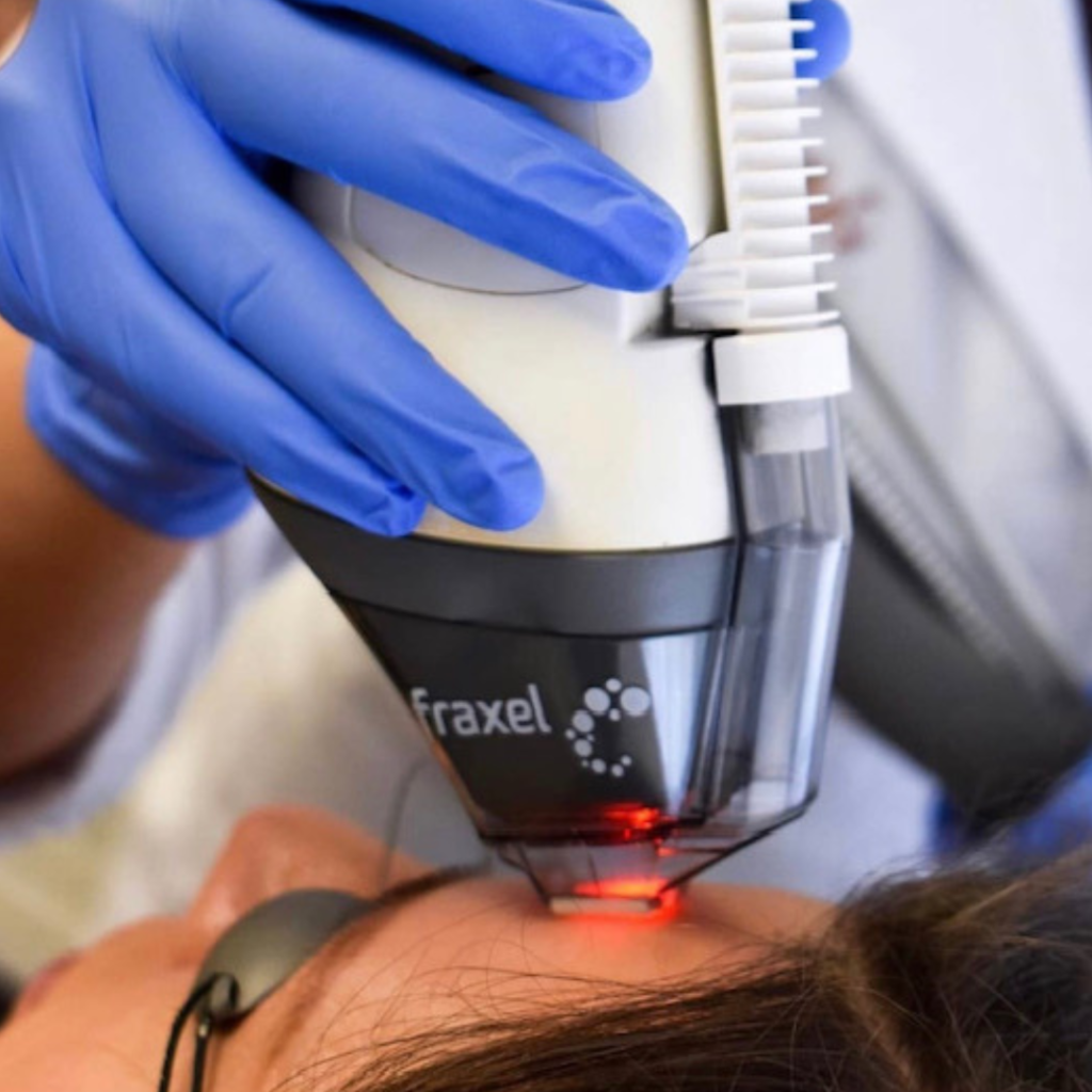 Fraxel laser Darien