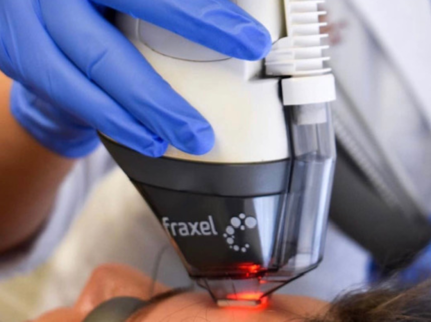 Fraxel laser Darien