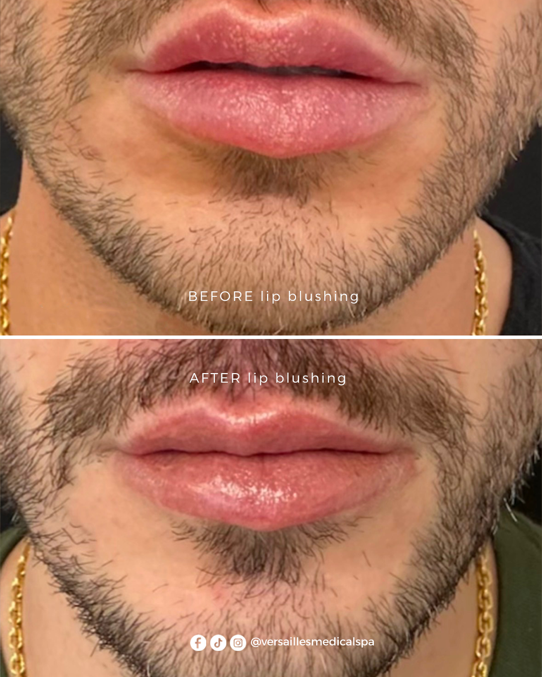 lip blushing men