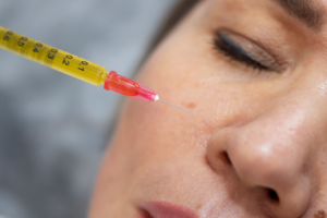 PRP vampire facial Darien