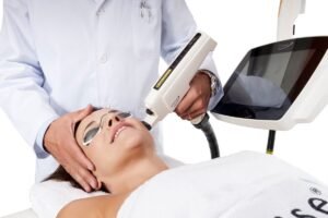 IPL photofacial Darien CT