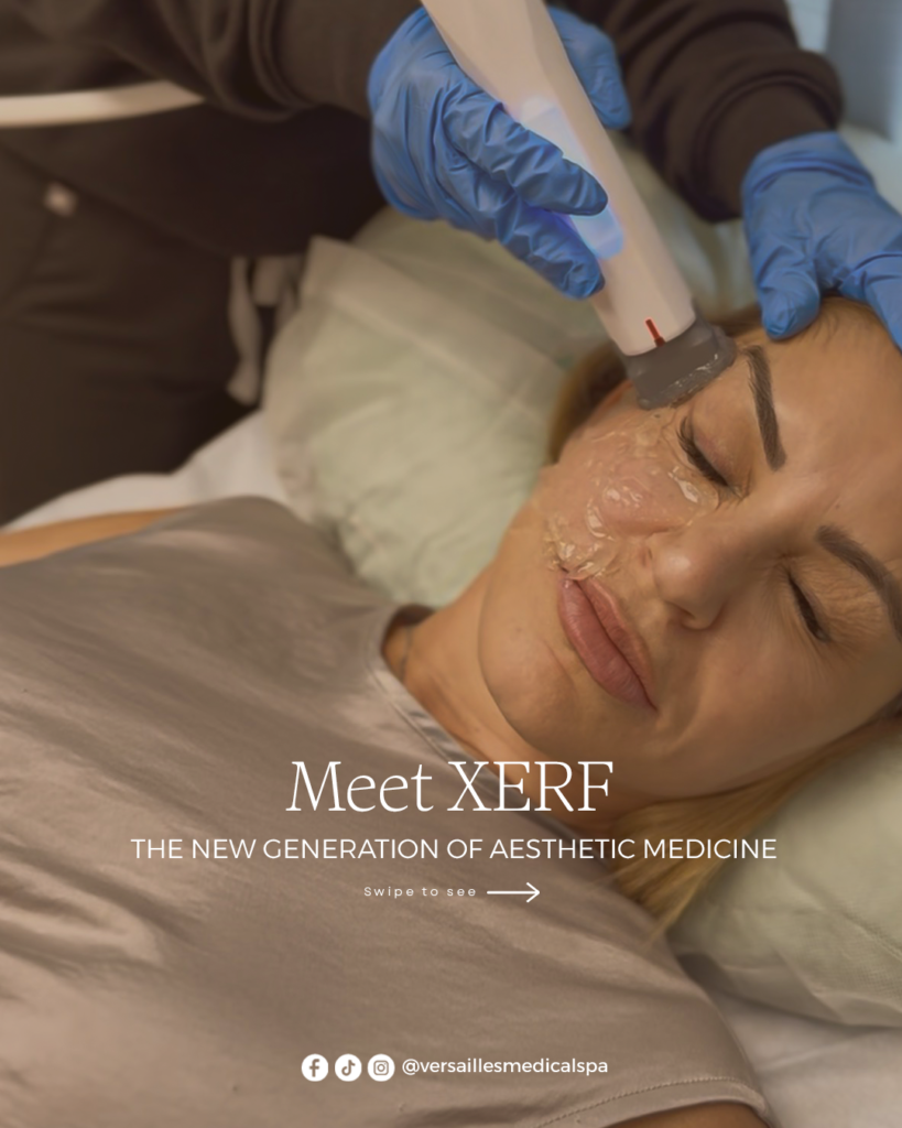 XERF treatment Darien CT