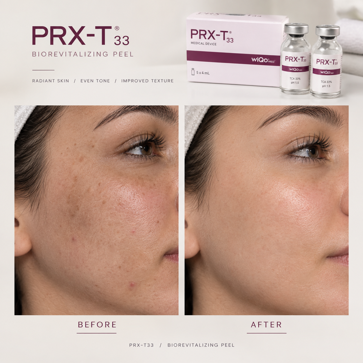 prx-t33