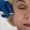 Sculptra benefits Darien CT